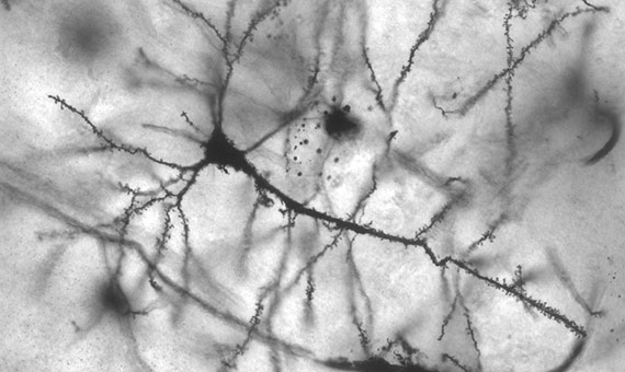 Neuronas del hipocampo amplificadas 40 veces