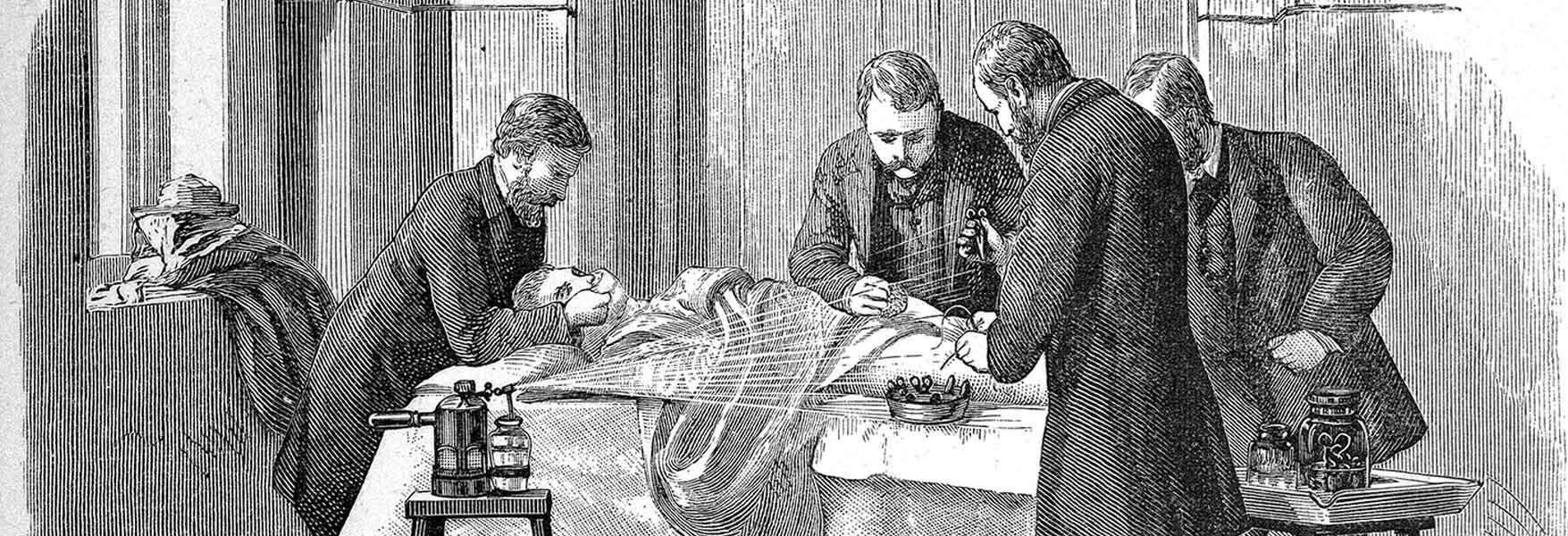 19th Century Surgery Using Antiseptic Spray By Science, 43% OFF